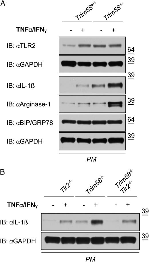 FIGURE 8. Deletion of Tlr2 inhibits increased cytokine sensitivity in Trim58-deficient myeloid cells. (A) Assessment of TLR2, mature IL-1β, arginase-1, and BIP/GRP78 protein synthesis in peritoneal myeloid (PM) cells from male Trim58+/+ and Trim58−/− mice (n = 4–6 per genotype) stimulated with TNF-α (100 ng/ml) and IFN-γ (5 ng/ml) for 24.5 h by immunoblot (IB) analysis. (B) Assessment of mature IL-1β protein synthesis in PM cells from male Tlr2−/−, Trim58−/− and Trim58−/−Tlr2−/− mice (n = 4–6/genotype) stimulated with TNF-α (100 ng/ml) and IFN-γ (5 ng/ml) for 24.5 h by IB analysis. Blots were reprobed with anti-GAPDH to confirm equal loading. Right margin, molecular size markers (kDa). Representative results of at least two independent experiments are shown.
