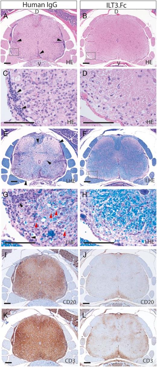 Suppression of Experimental Autoimmune Encephalomyelitis by ILT3.Fc ...