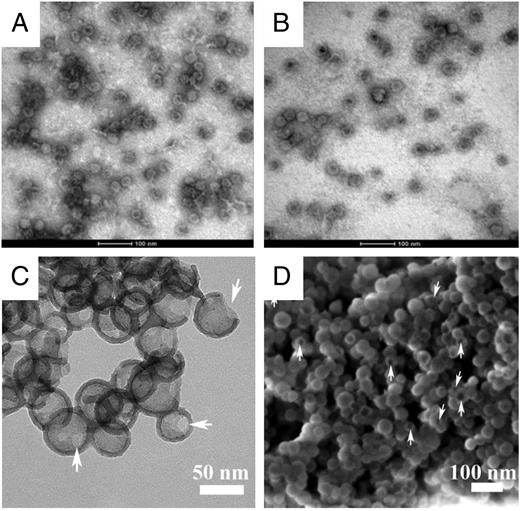FIGURE 1. Electron microscope (EM) images of VLPs and SV-140–C18. Transmission EM analysis of (A) HBcAg-p67C VLPs, (B) HBcAg VLPs, and (C) SV-140–C18, as well as (D) scanning EM analysis of SV-140–C18. Arrows indicate entrances on the shells of SVs in both (C) and (D).