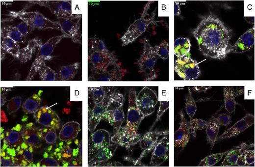 FIGURE 2. Confocal fluorescence microscopy of RAW 264.7 cells following incubation with SVs. The images are of (A) RAW 264.7 cells alone, (B) cells with SV-140–C18, (C) cells with SV-p67C–FITC, (D) cells with SV-p67C–FITC in the presence of ISA 206 VG, (E) s-p67C–FITC, and (F) s-p67C–FITC in the presence of ISA 206 VG. Acidic organelles in the cells were stained red with Lysotracker Red DND-99, cell membranes were stained white with wheat germ agglutinin, Alexa Fluor 647 conjugate (WGA-647) and nuclei were stained blue with Hoechst 33342. FITC is represented in green, and the colocalization of Ag in endosomes appears orange because of an overlap of red and green (white arrows indicate the colocalization of Ag in the endosomes). The assays were performed in duplicate, and the best images are shown.