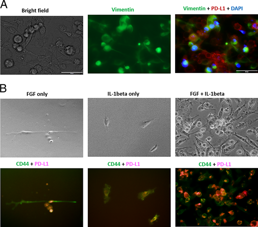 FIGURE 2. IL-1β and FGF contribute to the formation of stromal PD-L1 clusters in bone marrow cell cultures. (A) Freshly obtained naive bone marrow cells were cultured in a 24-well plate in the presence of an MBT2 TCM. Seven days later, cell cultures were stained with DAPI (blue), anti-vimentin (green), and PD-L1 (magenta) Abs. (B) Naive bone marrow cells were cultured in a 24-well plate in the presence of recombinant murine IL-1β and basic FGF. On day 7, the expression of PD-L1 (red) and CD44 (green) were evaluated using IF microscopy. Representative images are shown.