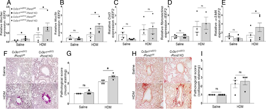 FIGURE 4. Lung mucin and α-SMA increased in Cx3cr1creERT2-Plxnd1 KO mice. (A–E) Expression levels of airway remodeling Muc5ac (A), Muc5b (B), Col3 (C), fibronectin (D), and α-SMA (E) genes in Cx3cr1creERT2-Plxnd1fl/fl and Cx3cr1creERT2-Plxnd1 KO mice was determined by qRT-PCR using specific primers. (F and H) Lung tissue sections from Cx3cr1creERT2-Plxnd1fl/fl and Cx3cr1creERT2-Plxnd1 KO mice were stained with periodic acid–Schiff and Sirius red to determine mucus (F) and collagen deposition (H), respectively. Scale bars, 50 μm. (G and I) Scoring data of lung mucus (G) and collagen (I) staining was blindly done by three people. Data are expressed as mean with SEM. n = 3–5 mice per group. *p < 0.05.
