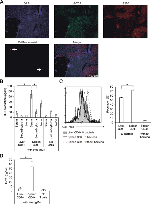 FIGURE 6. Phagocytic liver B cells initiate adaptive immune responses on encountering Th cells in the spleen, but not in the liver. (A) Distribution of phagocytic liver B cells (pHrodo–S. pneumoniae+IgM+ cells) in the spleen of wild-type mice 7 d after adoptive transfer. pHrodo–S. pneumoniae+IgM+ cells were labeled with CellTrace Violet beforehand. Arrows indicate B cells labeled with CellTrace Violet. The other two experiments showed similar trends. (B–D) Primed spleen, but not liver, CD4+ T cells produce IL-2 in the culture with liver B cells ingesting S. pneumoniae. Liver and spleen CD4+ cells were magnetically sorted from mice treated with heat-killed S. pneumoniae 7 d earlier. These primed T cells were cultured with heat-killed S. pneumoniae plus magnetically sorted liver IgM+ cells from naive mice in the presence of serum, serum plus cytochalasin D, or none. After culture for 4 d, their culture supernatant was examined for IL-2 (B) and IL-21 (D) production, while cultured cells were analyzed for division in their CD4+ cells labeled with CellTrace Violet beforehand (C). (C) Bars in the right panel show the population (%) of the designated CellTracelow cells in each group of CD4+ cells in the left panel. Data are shown as the mean ± SEM from four to six samples in each group. *p &lt; 0.05. The other two experiments showed similar trends (A and C, left panel).