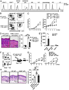 CD96 on dermal γδ T cells is involved in IMQ-induced psoriasis-like dermati...