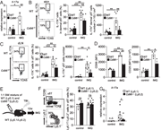 CD96 on dermal γδ T cells augments IL-17A expression after IMQ treatment. (...