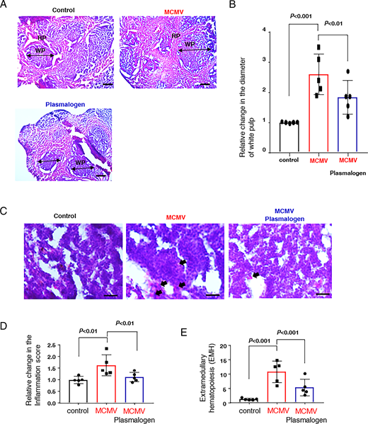 FIGURE 11. Drinking Pls reduces splenic inflammation in the virus-infected mice. (A) H&amp;E staining of the spleen tissues in the experimental groups (white pulp [WP] and red pulp [RP]) (scale bars, 100 μm). (B) The data show the relative changes in the diameter of the WP in the experimental groups (n = 5). (C) Enlarged view of the splenic WP areas of the experimental groups shows the differences in the diameter of cells (relative population of the cells with an enhanced cell diameter, considered as inflammation, is shown in D). The arrowheads indicate the enlarged nuclei of the cells (scale bars, 100 µm). (E) Extramedullary hematopoiesis (EMH) in the RP area of the spleen tissues was scored (images are not shown) and plotted as relative quantity in each group (n = 5). The p values (B, D, and E) were calculated by one-way ANOVA followed by Bonferroni’s post hoc test.