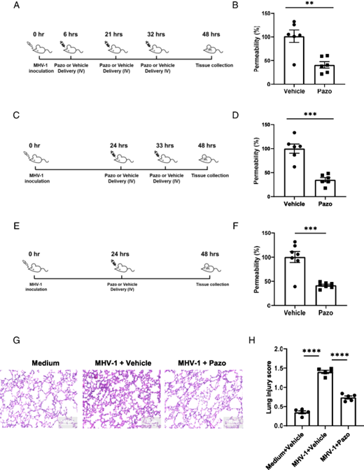 FIGURE 2. Pazopanib treatment can reduce MHV-1–induced lung injury. (A, C, and E) Schematic diagram of the different regimens of pazopanib treatment. (B, D, and F) BAL was collected 48 h after MHV-1 infection and pulmonary permeability was examined. Data in (B) were combined from two independent experiments. The vehicle group included four and two mice per experiment. The pazopanib group included five or one mouse per experiment; each datum represents one mouse. Data in (D) were combined from two independent experiments with four or two mice per group per experiment; each datum represents one mouse. Data in (F) were combined from three independent experiments; in each independent experiment, each group contained two or three mice, and each datum represents one mouse. (G and H). A/J mice (8 wk old) were intranasally infected with medium or 5000 PFU of MHV-1. Pazopanib or vehicle was delivered 24 h after MHV-1 inoculation. At 48 h postinfection, mice were sacrificed and lungs were collected for histology analysis. Representative lung histology images (H&amp;E staining) are shown in (G). Quantification of lung injuries in (H). Each datum is the average score of five fields, which were uniformly and randomly picked from one lung section of one mouse. Five mice were included in each group. The samples were collected from two independent experiments with three or two mice per group per experiment. The samples were then combined for the following processing, staining, and evaluation. Data in (B), (D), and (F) are presented as means ± SEM (Student t test), and data in (H) are presented as means ± SEM (one-way ANOVA). **p &lt; 0.01, ***p &lt; 0.001; ns, not significant.