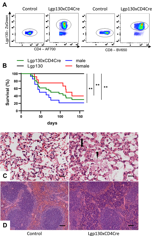 Constitutively active Lgp130 in T cells causes lung inflammation and early death of mice. (A) Representative ZsGreen fluorescence of CD4+ and CD8+ T cells from spleens of Lgp130 control and Lgp130 × CD4Cre mice. (B) Survival of control (Lgp130) mice (n = 8), Lgp130 × CD4Cre mice (n = 27, median survival 97 d), and male (n = 15, median survival 64 d) or female (n = 12, median survival 123 d) Lgp130 × CD4Cre mice. **p < 0.01. (C and D) Sections from lung and spleen from 12-wk-old Lgp130 control and Lgp130 × CD4Cre mice were stained with H&E. (C) Representative sections of lungs reveal thickened alveolar walls (arrow), mononuclear cell infiltration, and foam cells in alveoli (arrowhead) of Lgp130 × CD4Cre mice. Scale bars, 20 µm. (D) Representative sections of spleens show lymphocyte accumulation in the red pulp of Lgp130 × CD4Cre mice. Scale bars, 100 µm.